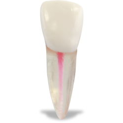 Real‑T Endo Maxillary Right Central Incisor (Radiolucent)
