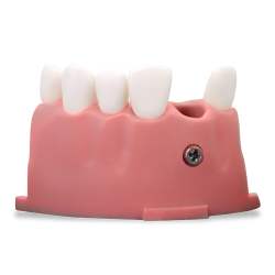 RT OS3 (Endo/Pros) Upper Anterior Mod 07‑12 w/M300 Teeth